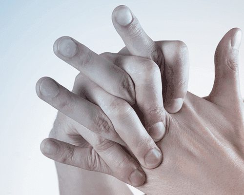 Romatoid Artrit (İltihaplı Romatizma) Tedavisi – Tüm Soru Cevaplar Romatoid Artrit (İltihaplı Romatizma) Tedavisi – Tüm Soru Cevaplar