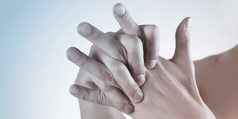 Romatoid Artrit (İltihaplı Romatizma) Tedavisi – Tüm Soru Cevaplar Romatoid Artrit (İltihaplı Romatizma) Tedavisi – Tüm Soru Cevaplar