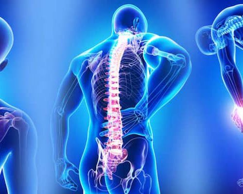 Fibromiyalji, Yumuşak doku romatizması nedir ? Fibromiyalji, Yumuşak doku romatizması nedir ?