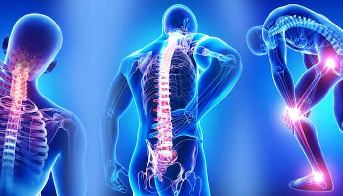 Fibromiyalji, Yumuşak doku romatizması nedir ? Fibromiyalji, Yumuşak doku romatizması nedir ?